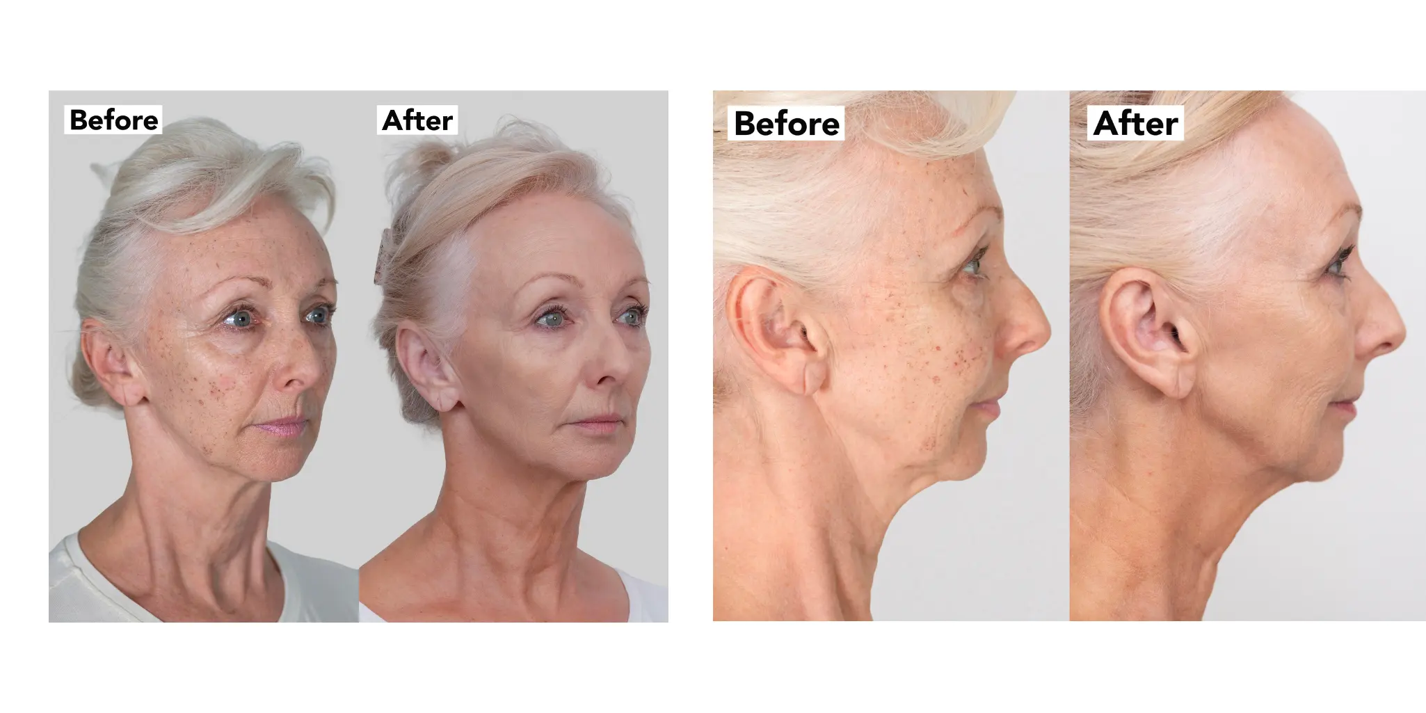 ‘My age spots are gone’ - Debbie McGee, 67, has '20 years younger' skin transformation