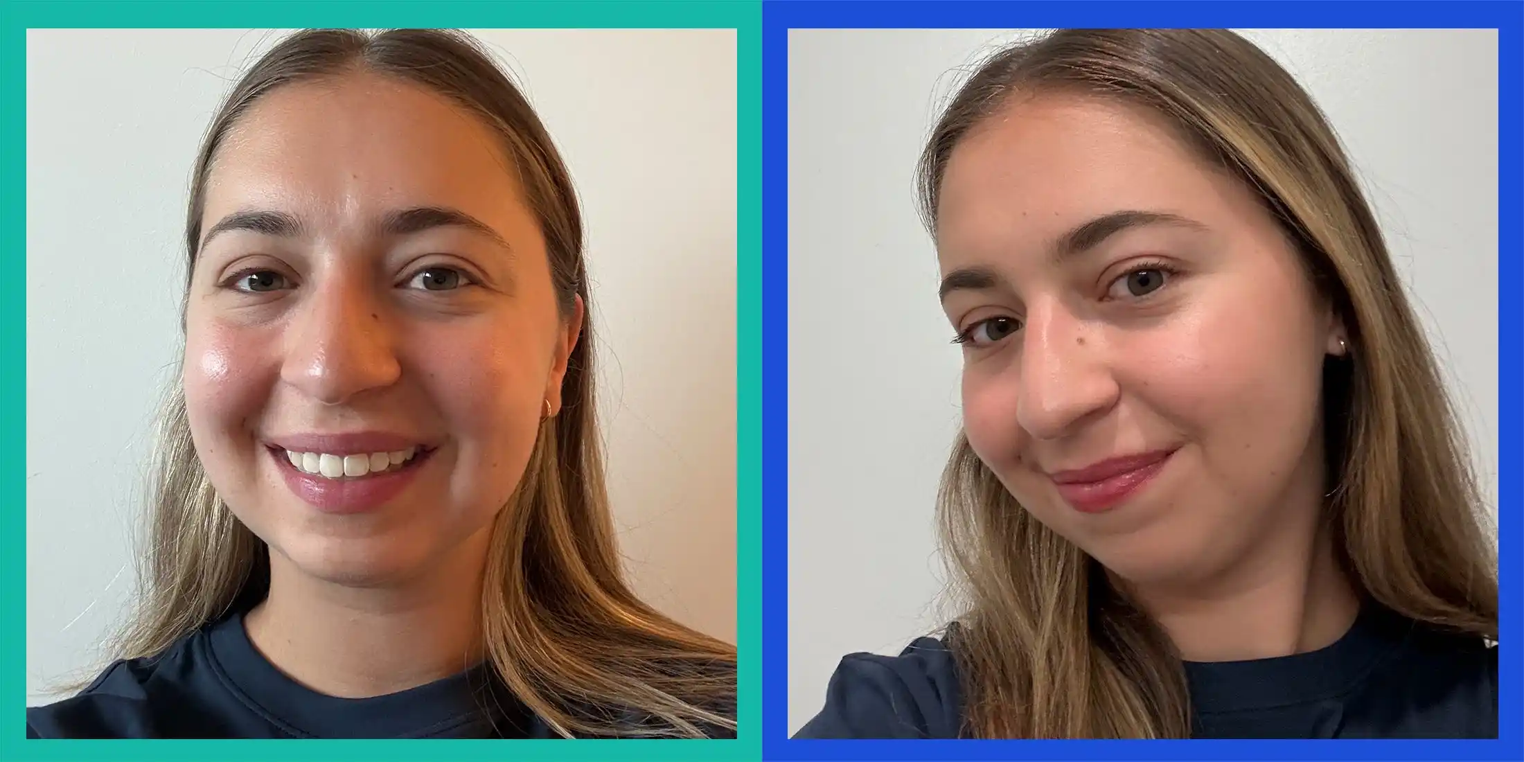 I Tried Clinique’s New Line For Sensitive Skin. Here’s How My Very Reactive Complexion Responded.